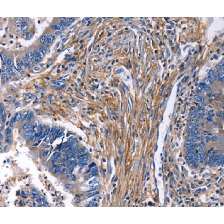 Immunohistochemistry - CXCR5 Antibody from Signalway Antibody (36815) - Antibodies.com