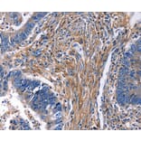 Immunohistochemistry - CXCR5 Antibody from Signalway Antibody (36815) - Antibodies.com