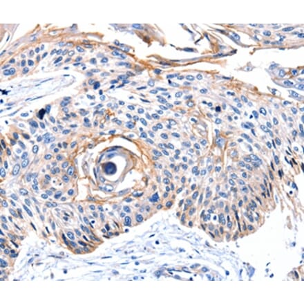 Immunohistochemistry - CCNB2 Antibody from Signalway Antibody (36818) - Antibodies.com