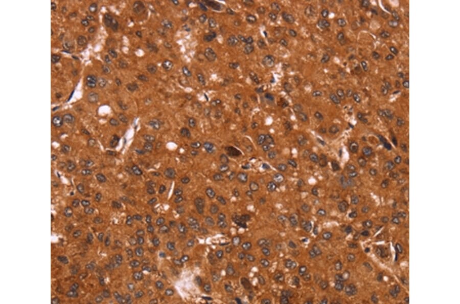 Immunohistochemistry - CCND3 Antibody from Signalway Antibody (36819) - Antibodies.com