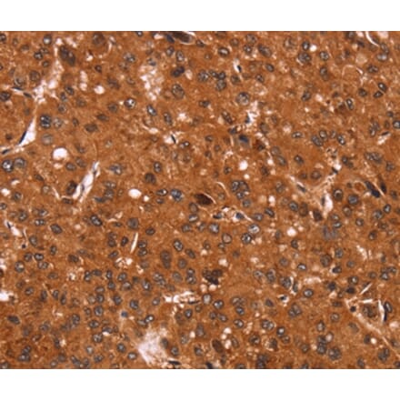 Immunohistochemistry - CCND3 Antibody from Signalway Antibody (36819) - Antibodies.com