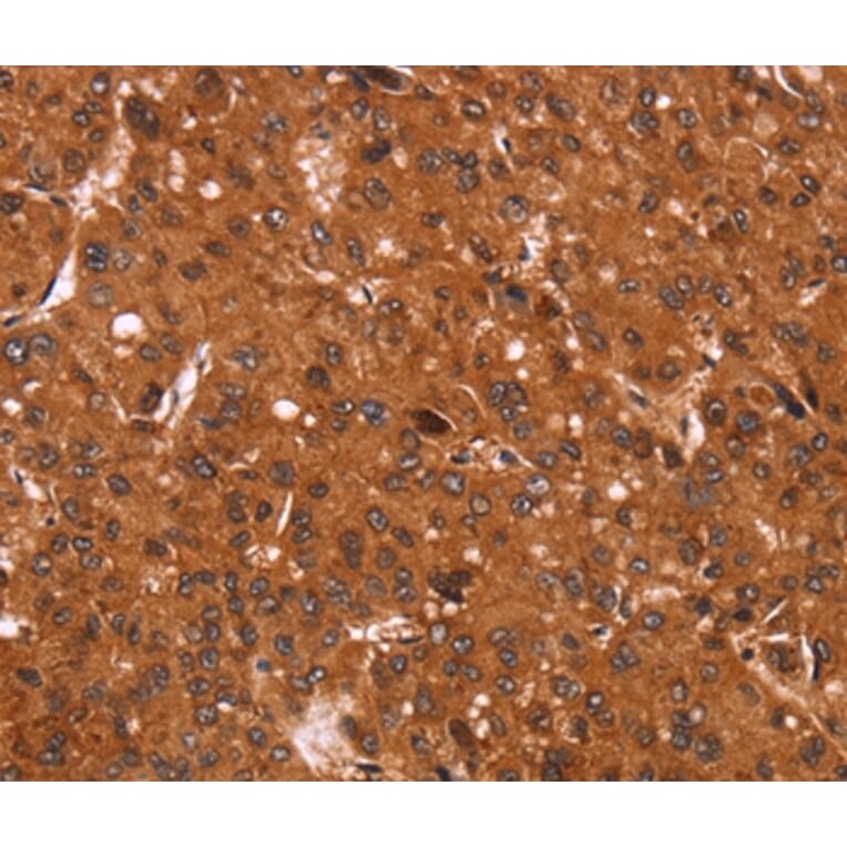 Immunohistochemistry - CCND3 Antibody from Signalway Antibody (36819) - Antibodies.com