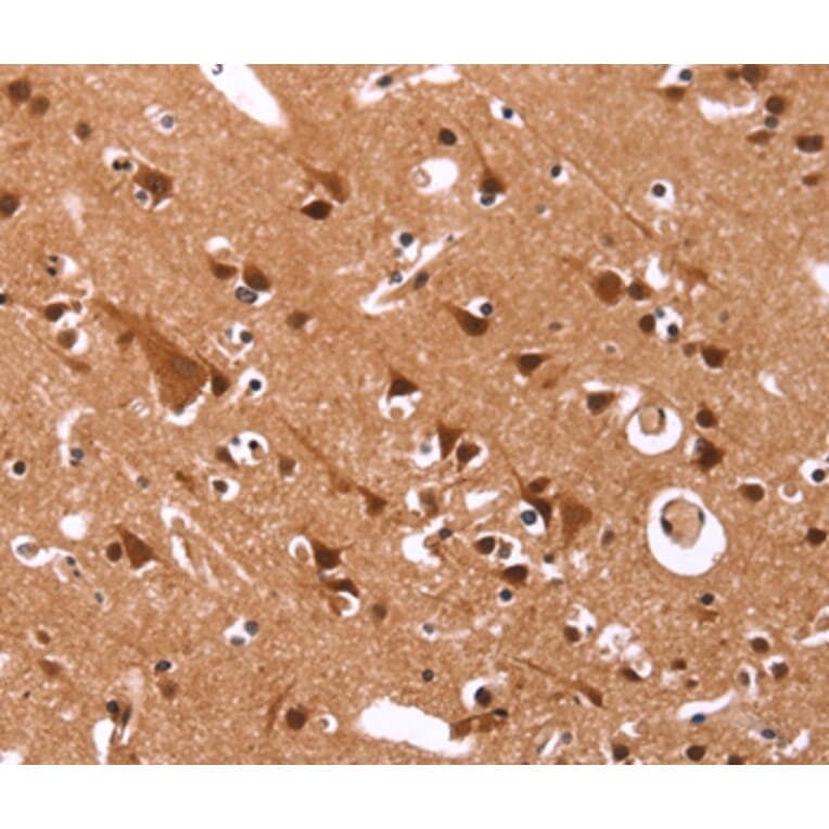 Immunohistochemistry - CCND3 Antibody from Signalway Antibody (36819) - Antibodies.com