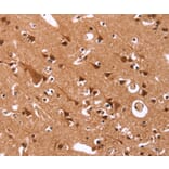 Immunohistochemistry - CCND3 Antibody from Signalway Antibody (36819) - Antibodies.com