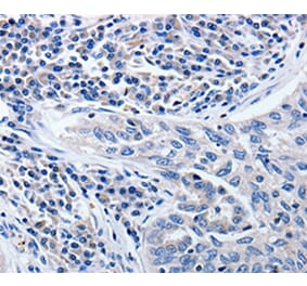 Immunohistochemistry - CCNE1 Antibody from Signalway Antibody (36820) - Antibodies.com