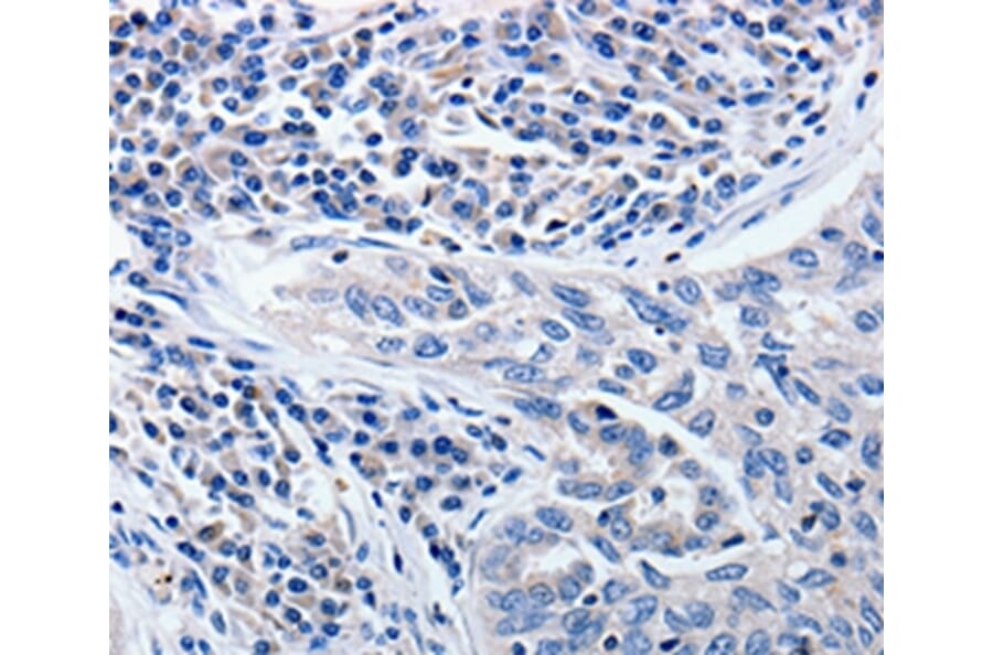 Immunohistochemistry - CCNE1 Antibody from Signalway Antibody (36820) - Antibodies.com