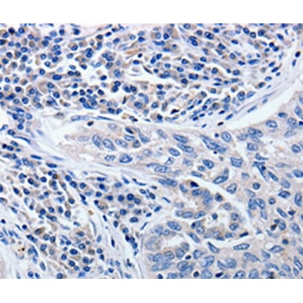 Immunohistochemistry - CCNE1 Antibody from Signalway Antibody (36820) - Antibodies.com