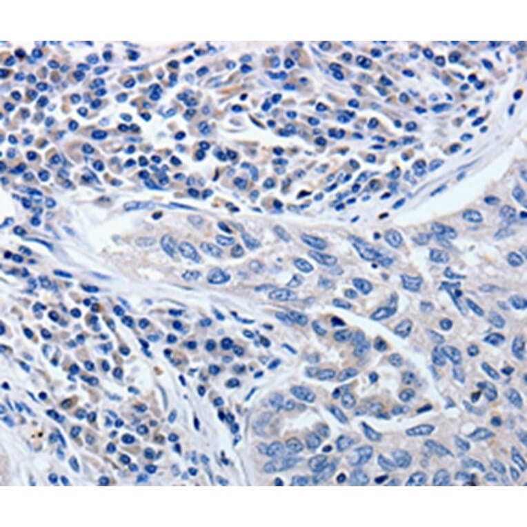 Immunohistochemistry - CCNE1 Antibody from Signalway Antibody (36820) - Antibodies.com