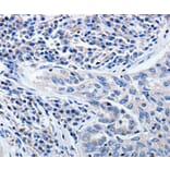 Immunohistochemistry - CCNE1 Antibody from Signalway Antibody (36820) - Antibodies.com