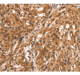 Immunohistochemistry - CCNE2 Antibody from Signalway Antibody (36821) - Antibodies.com