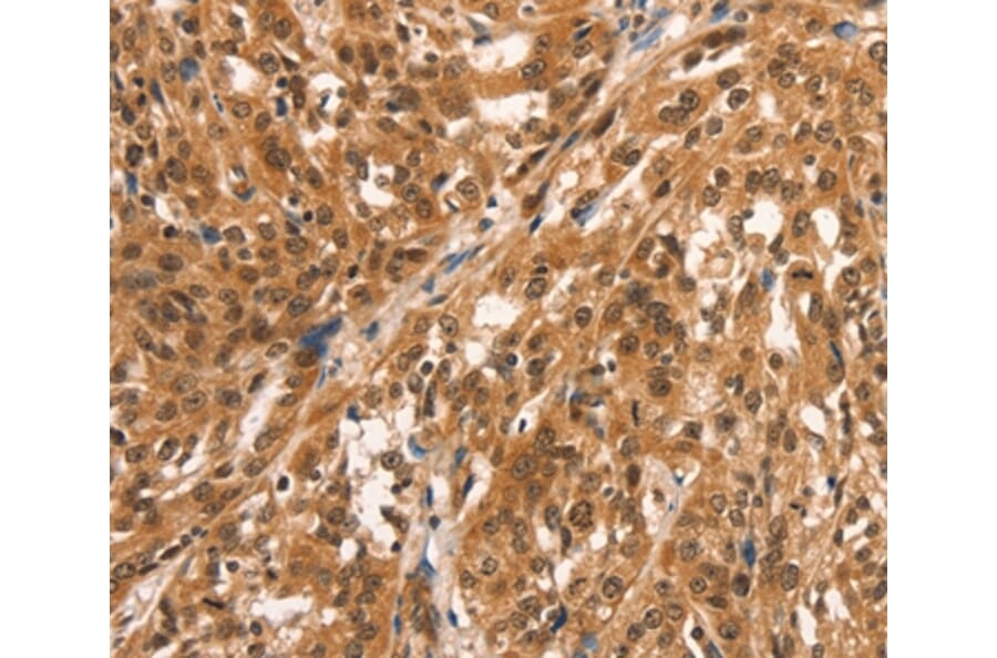 Immunohistochemistry - CCNE2 Antibody from Signalway Antibody (36821) - Antibodies.com