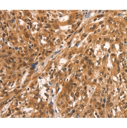 Immunohistochemistry - CCNE2 Antibody from Signalway Antibody (36821) - Antibodies.com
