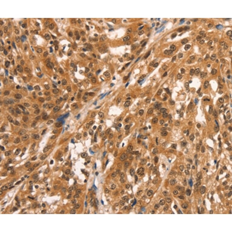 Immunohistochemistry - CCNE2 Antibody from Signalway Antibody (36821) - Antibodies.com