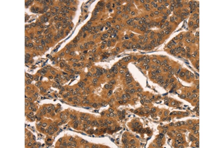 Immunohistochemistry - CCNE2 Antibody from Signalway Antibody (36821) - Antibodies.com