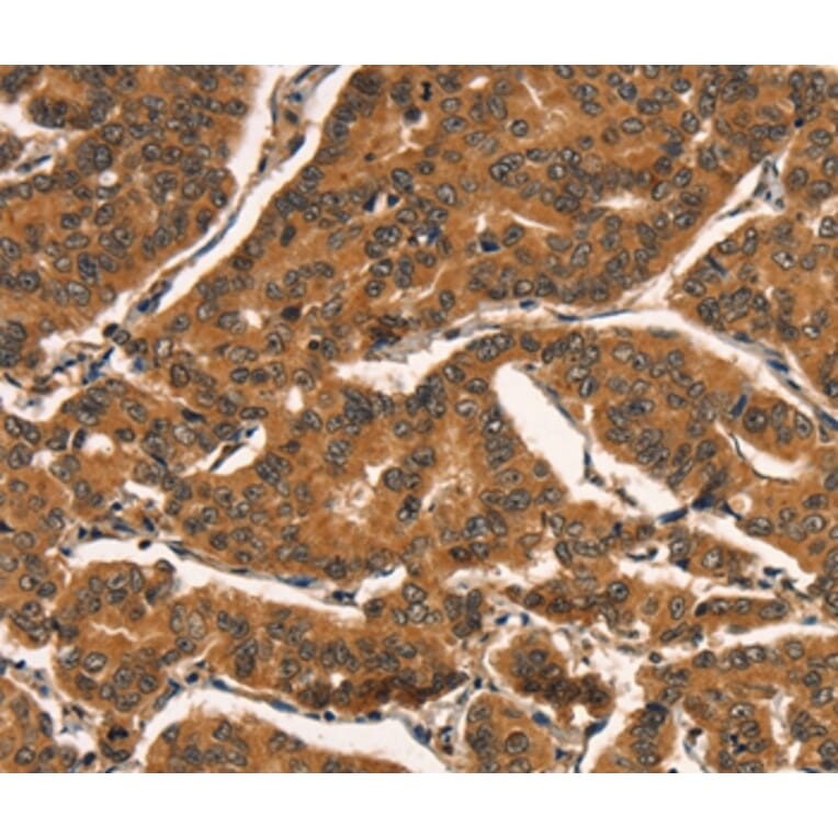 Immunohistochemistry - CCNE2 Antibody from Signalway Antibody (36821) - Antibodies.com