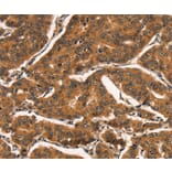 Immunohistochemistry - CCNE2 Antibody from Signalway Antibody (36821) - Antibodies.com