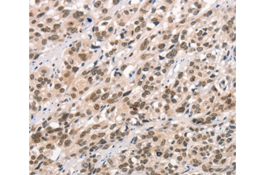 Immunohistochemistry - CCNT1 Antibody from Signalway Antibody (36822) - Antibodies.com