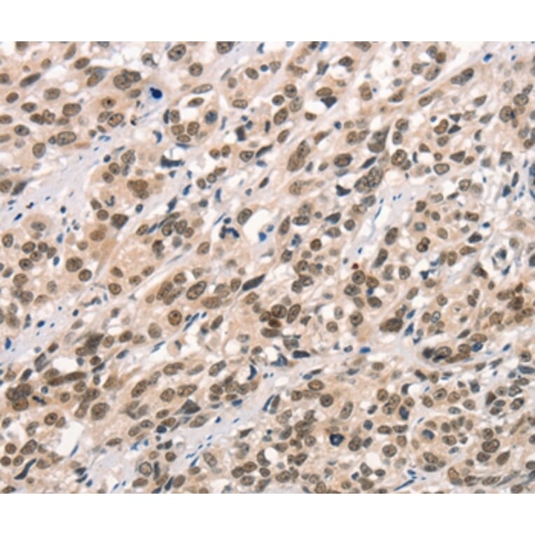 Immunohistochemistry - CCNT1 Antibody from Signalway Antibody (36822) - Antibodies.com