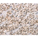 Immunohistochemistry - CCNT1 Antibody from Signalway Antibody (36822) - Antibodies.com
