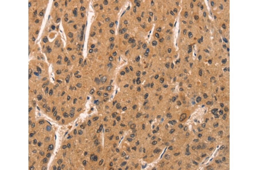 Immunohistochemistry - CCNT1 Antibody from Signalway Antibody (36822) - Antibodies.com
