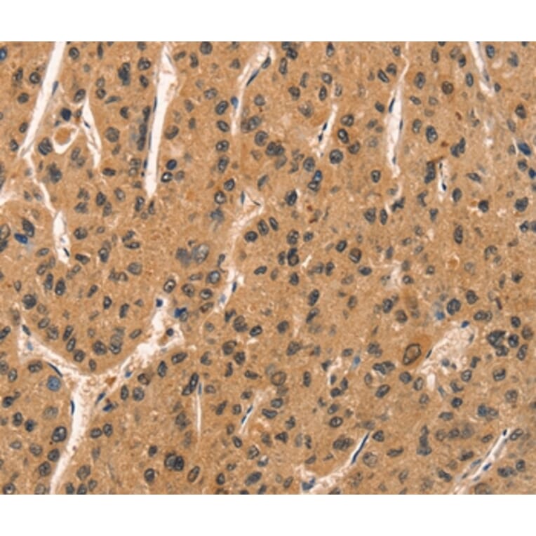 Immunohistochemistry - CCNT1 Antibody from Signalway Antibody (36822) - Antibodies.com