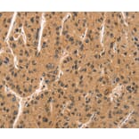 Immunohistochemistry - CCNT1 Antibody from Signalway Antibody (36822) - Antibodies.com