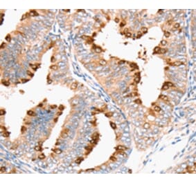 Immunohistochemistry - DNMT1 Antibody from Signalway Antibody (36826) - Antibodies.com