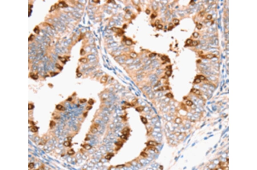 Immunohistochemistry - DNMT1 Antibody from Signalway Antibody (36826) - Antibodies.com