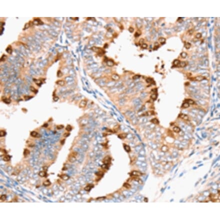 Immunohistochemistry - DNMT1 Antibody from Signalway Antibody (36826) - Antibodies.com