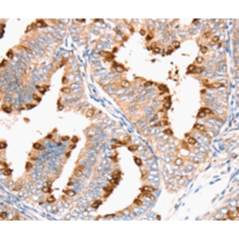 Immunohistochemistry - DNMT1 Antibody from Signalway Antibody (36826) - Antibodies.com