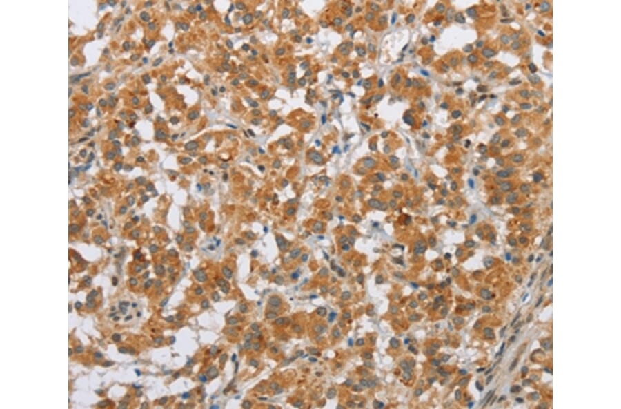 Immunohistochemistry - SFRP5 Antibody from Signalway Antibody (36839) - Antibodies.com