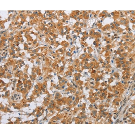 Immunohistochemistry - SFRP5 Antibody from Signalway Antibody (36839) - Antibodies.com