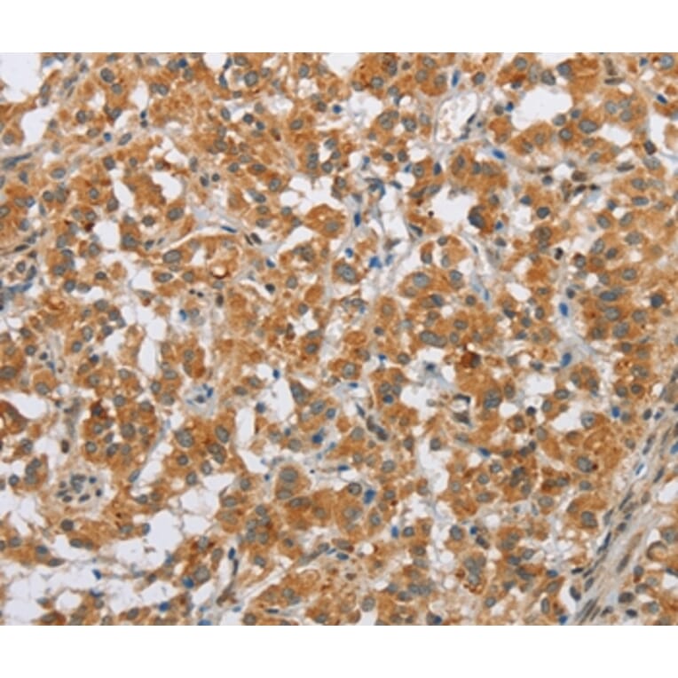 Immunohistochemistry - SFRP5 Antibody from Signalway Antibody (36839) - Antibodies.com
