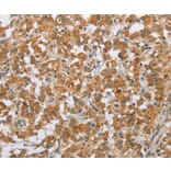 Immunohistochemistry - SFRP5 Antibody from Signalway Antibody (36839) - Antibodies.com