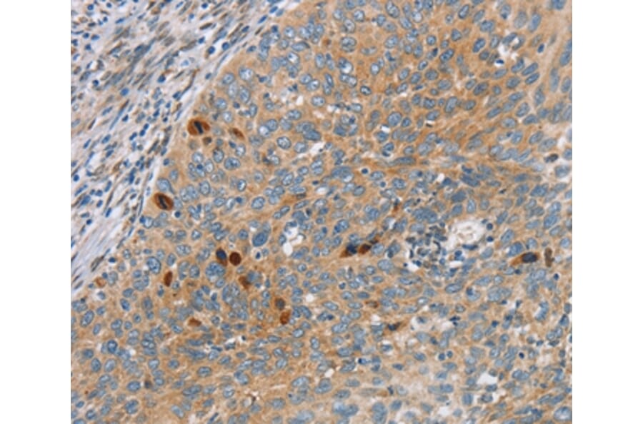 Immunohistochemistry - SFRP5 Antibody from Signalway Antibody (36839) - Antibodies.com
