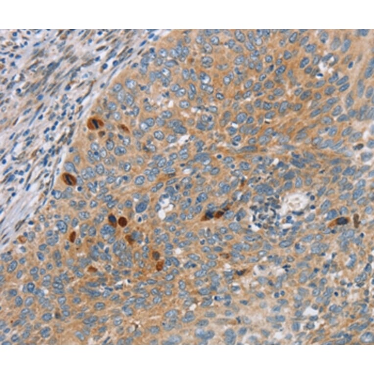 Immunohistochemistry - SFRP5 Antibody from Signalway Antibody (36839) - Antibodies.com