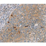 Immunohistochemistry - SFRP5 Antibody from Signalway Antibody (36839) - Antibodies.com