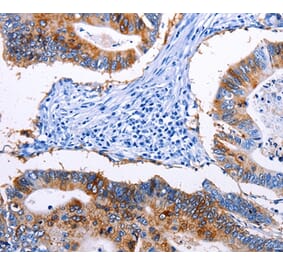 Immunohistochemistry - EPCAM Antibody from Signalway Antibody (36842) - Antibodies.com