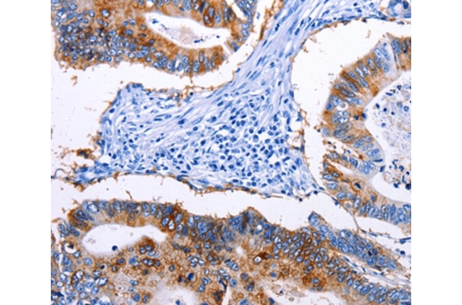 Immunohistochemistry - EPCAM Antibody from Signalway Antibody (36842) - Antibodies.com