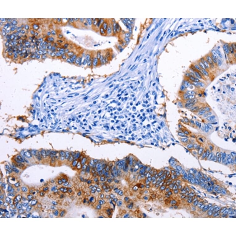 Immunohistochemistry - EPCAM Antibody from Signalway Antibody (36842) - Antibodies.com