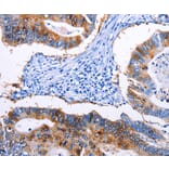 Immunohistochemistry - EPCAM Antibody from Signalway Antibody (36842) - Antibodies.com
