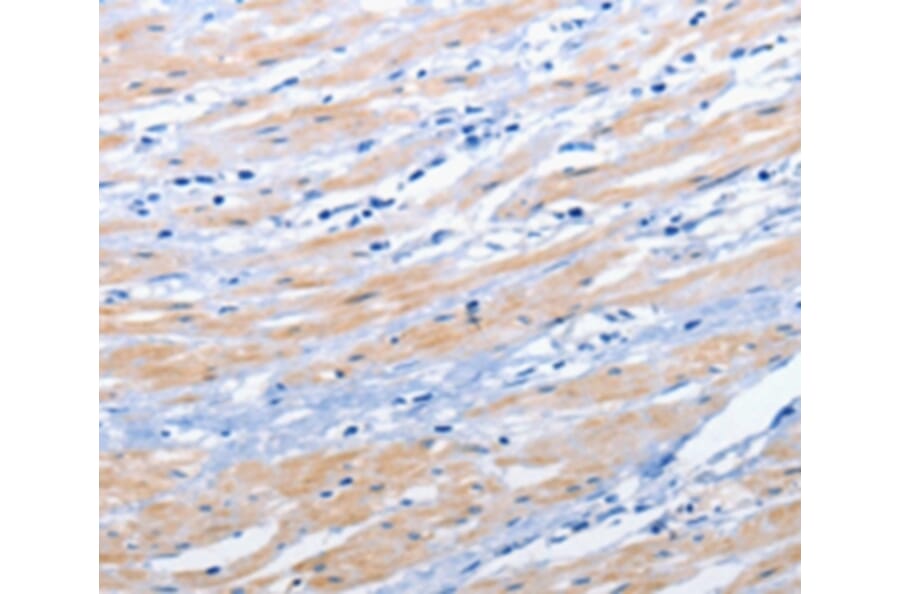Immunohistochemistry - EPHA1 Antibody from Signalway Antibody (36844) - Antibodies.com