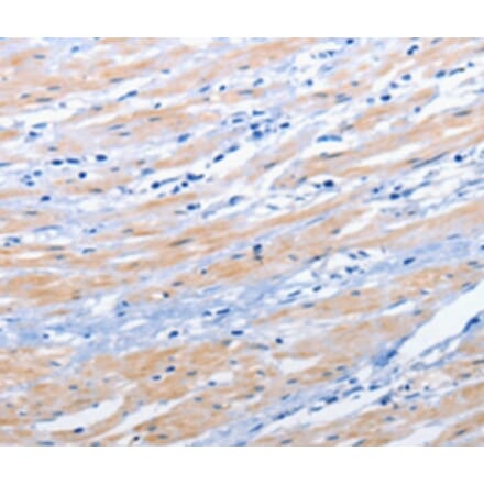 Immunohistochemistry - EPHA1 Antibody from Signalway Antibody (36844) - Antibodies.com