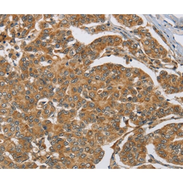 Immunohistochemistry - MAPK6 Antibody from Signalway Antibody (36847) - Antibodies.com