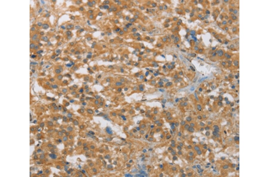 Immunohistochemistry - FASLG Antibody from Signalway Antibody (36850) - Antibodies.com