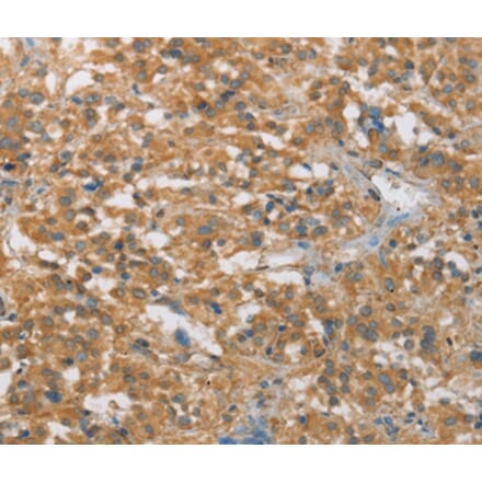 Immunohistochemistry - FASLG Antibody from Signalway Antibody (36850) - Antibodies.com
