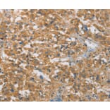 Immunohistochemistry - FASLG Antibody from Signalway Antibody (36850) - Antibodies.com