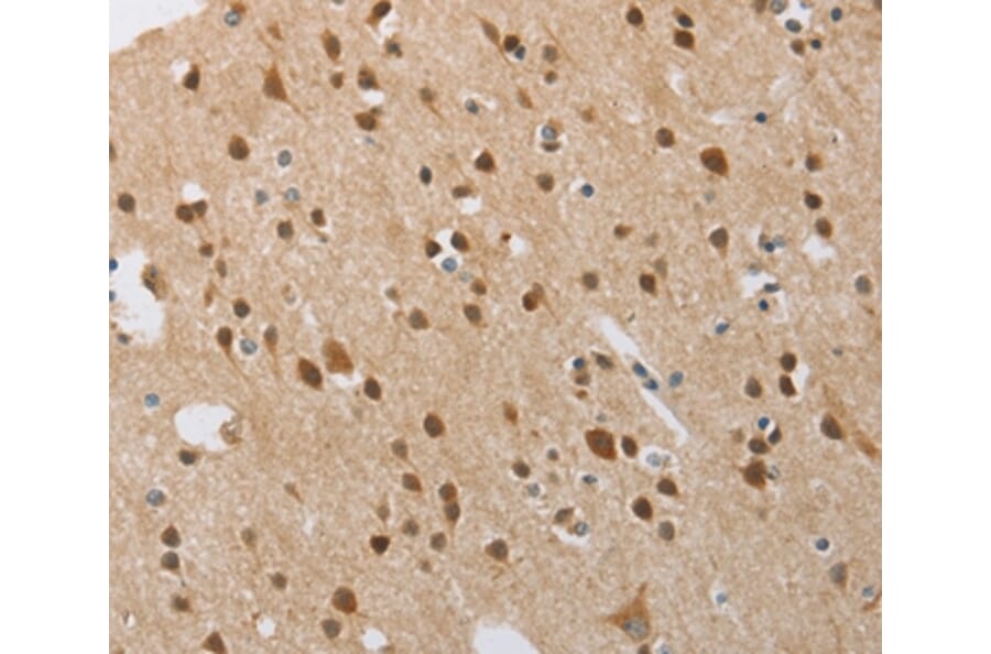 Immunohistochemistry - FASLG Antibody from Signalway Antibody (36850) - Antibodies.com