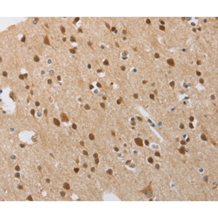 Immunohistochemistry - FASLG Antibody from Signalway Antibody (36850) - Antibodies.com