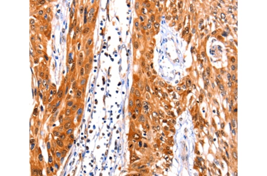 Immunohistochemistry - FBLN1 Antibody from Signalway Antibody (36852) - Antibodies.com